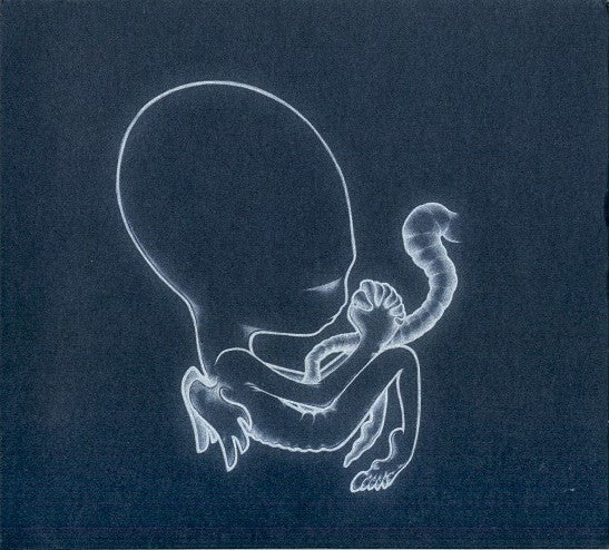 Agaetis Byrjun
